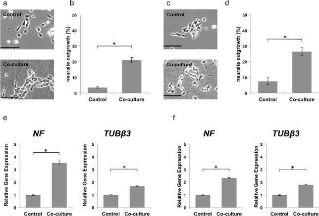 Effects of human dedifferentiated fat cells (DFATs) on neuroblastoma cell differentiation.