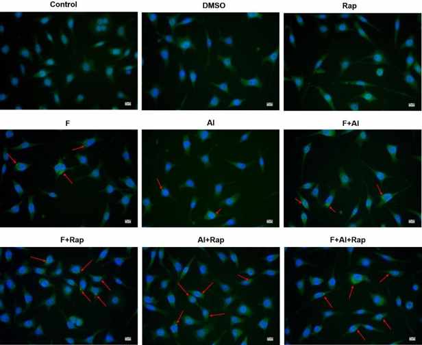 Fluorescence microscopy images of the autophagy in the NG108-15 cells. The red arrow represents the autophagosome with green fluorescent spots.
