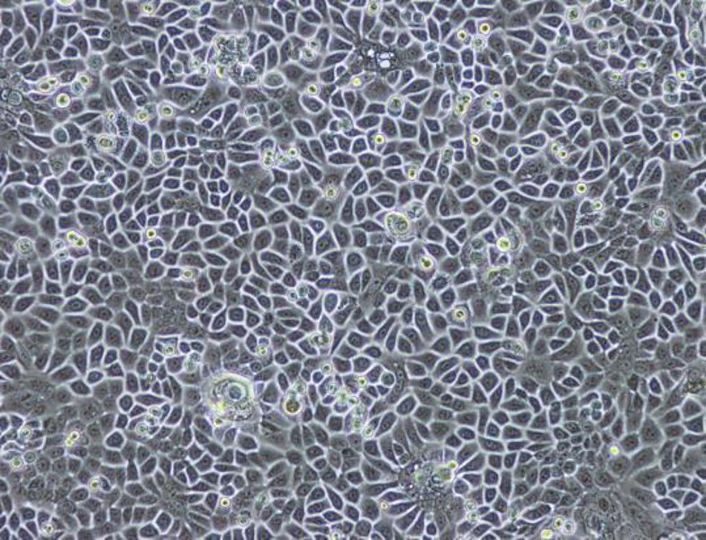 Primary culture of normal human epidermal keratinocytes and human dermal fibroblasts.