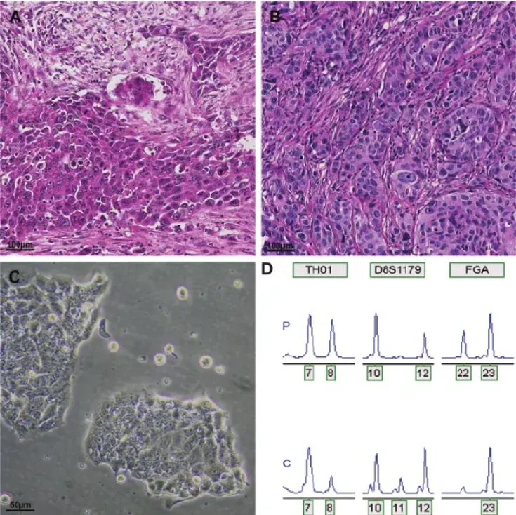 Authentication of human esophageal adenocarcinoma cell line OE33.