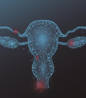 Microscopic image of ovarian cancer cell culture