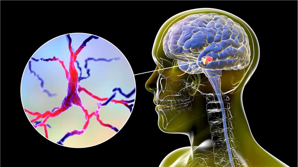 Parkinson's Disease (PD) Models