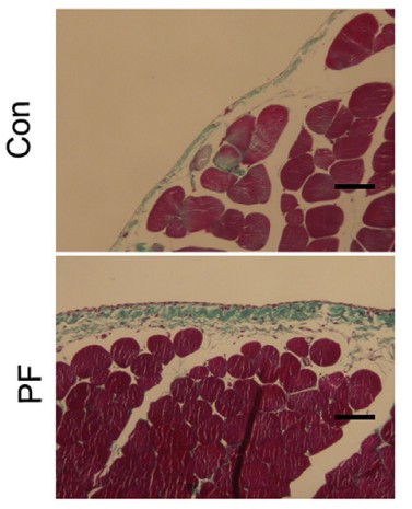 Fig.2: Representative photographs of Masson staining of parietal peritoneal membrane.