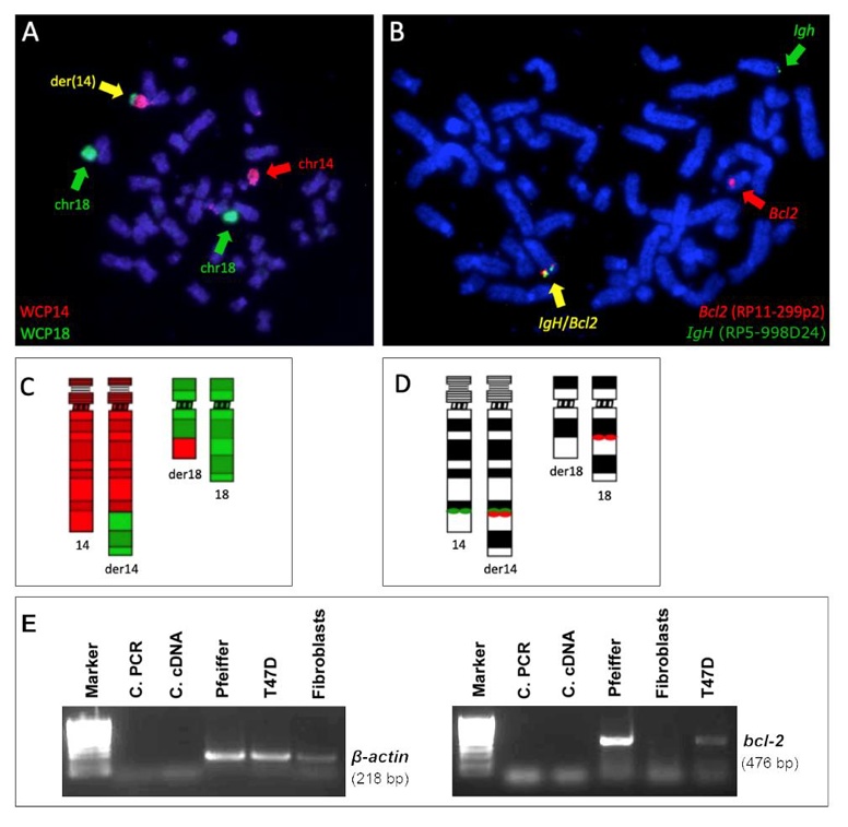 Visualization of t(14;18) in metaphase chromosomes of the Pfeiffer cell line.