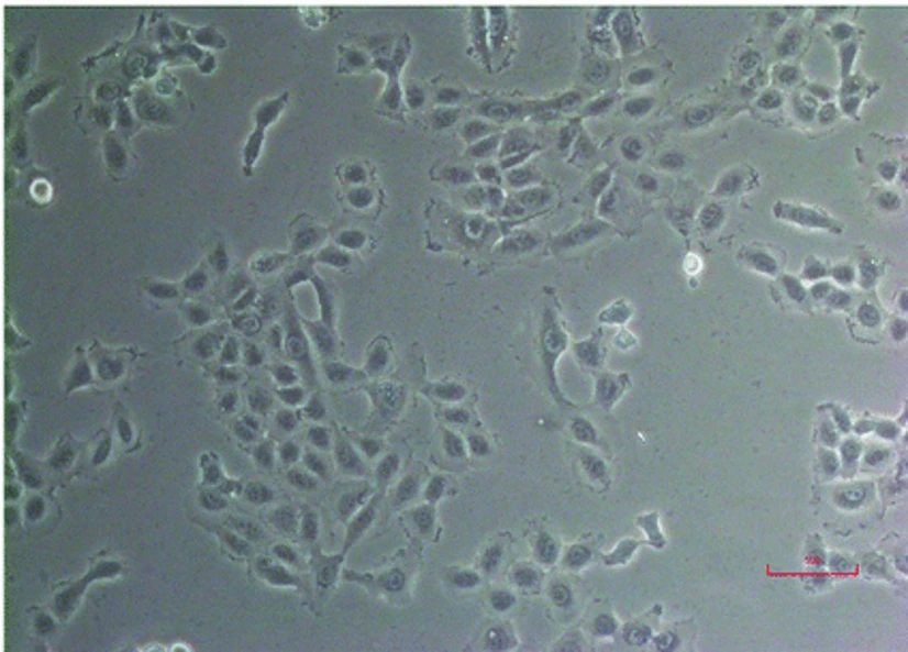 The hepatocellular carcinoma cell line PLC/PRF/5 .