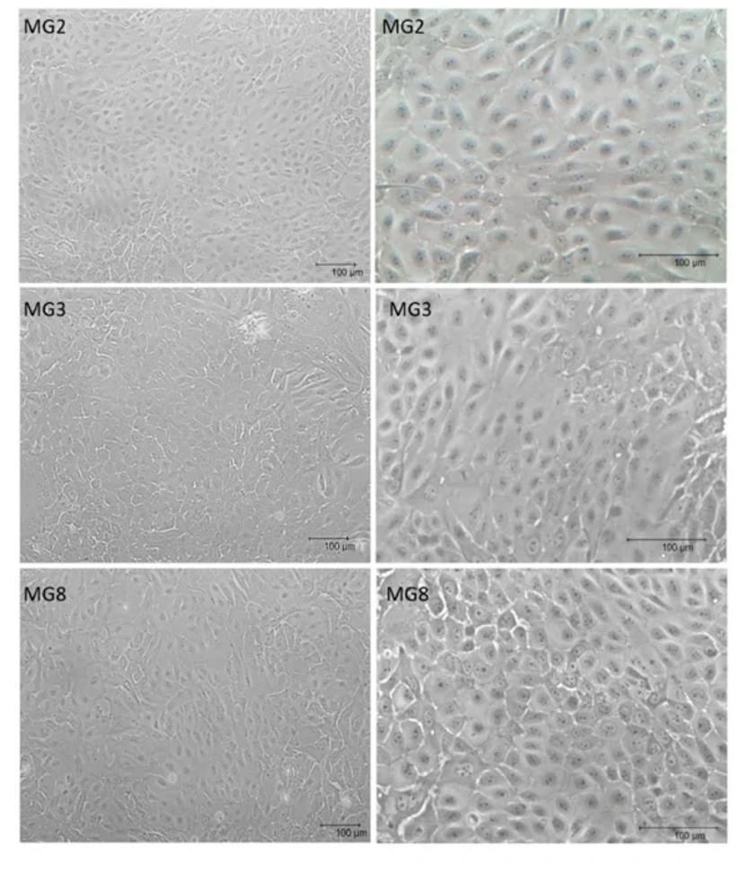 Porcine mammary epithelial cells of different samples.