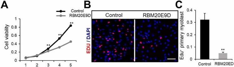 CCK-8 assay and EdU staining assessing the proliferation of RBM20E9D satellite cells.