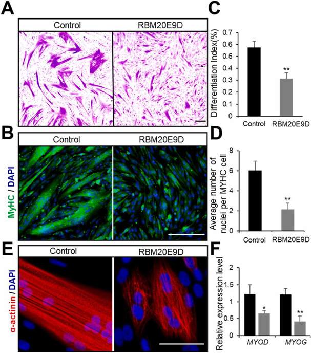 RBM20 exon 9 deletion leads to reduced differentiation capacity of porcine skeletal muscle satellite cells.