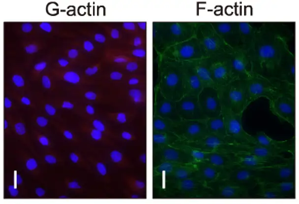 Images of actin filaments of bovine aortic endothelial cells