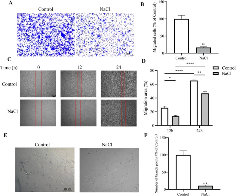 The effects of NaCl treatment on migration and angiogenic capacity of BAECs in vitro.