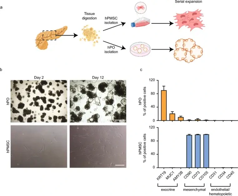 Human pancreatic organoids and mesenchymal stromal cells isolation.