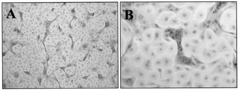 Morphology of the prostate epithelial cell culture.