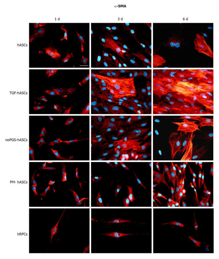α-Smooth muscle actin immunoreactivity (red fluorescence) evaluated after one day (left column, 1 d), three days (middle column, 3 d) and six days (right column, 6 d) of cell growth.