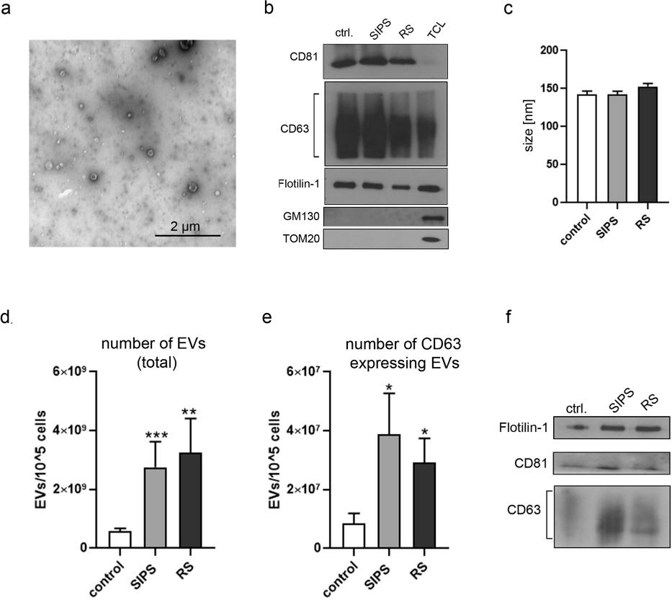 Characterization of extracellular vesicles secreted by VSMCs.