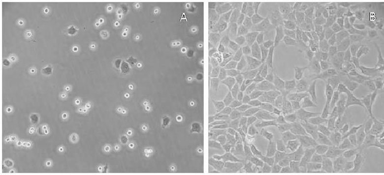Primary culture of rabbit chondrocytes.