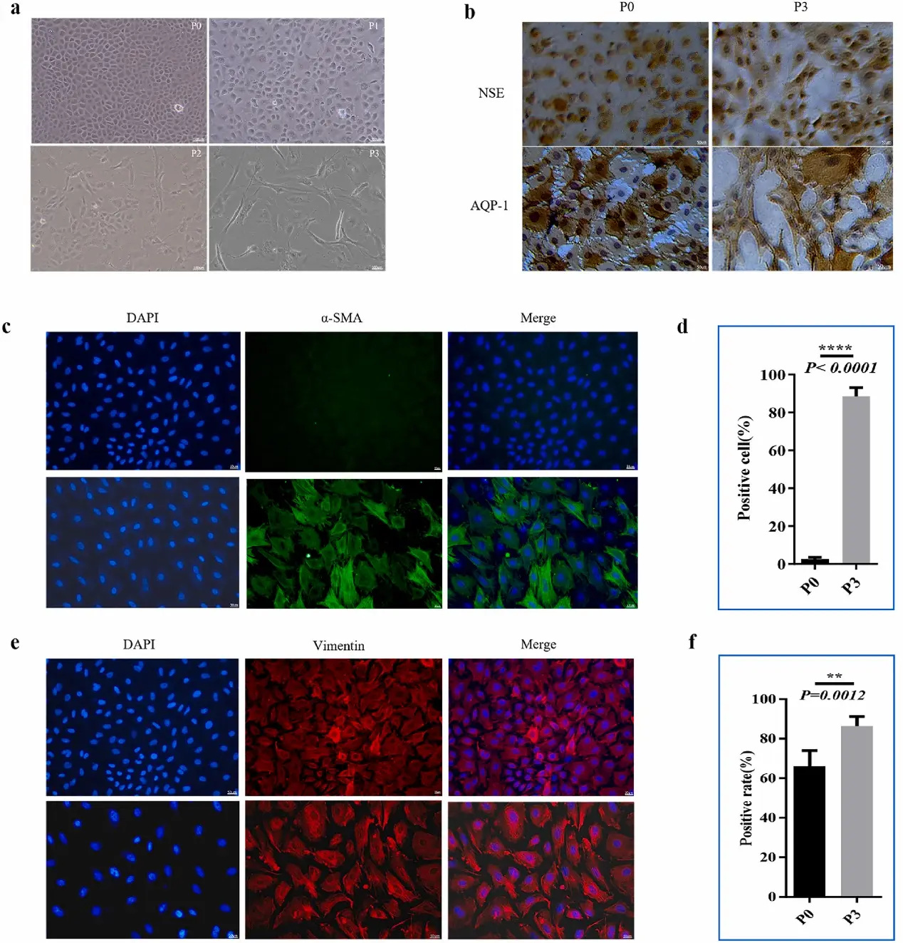 RCECs tend to undergo EndMT during in vitro culture.