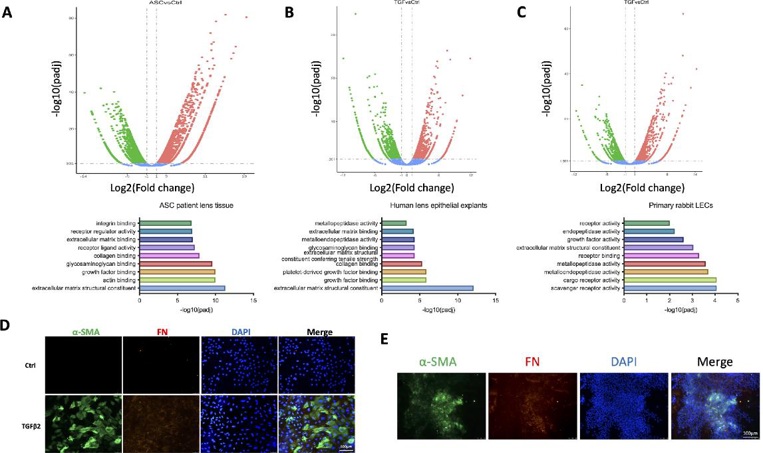 Molecular characteristics of lens fibrosis and TGFβ2-stimulated LECs.