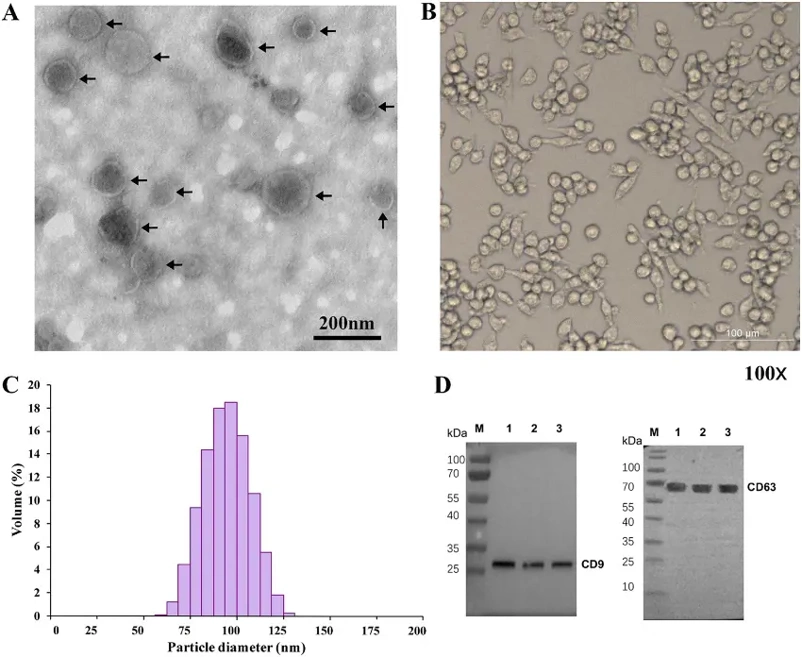 Characterization of T. pisiformis cysticercus-derived exosomes and rabbit peritoneal macrophages.