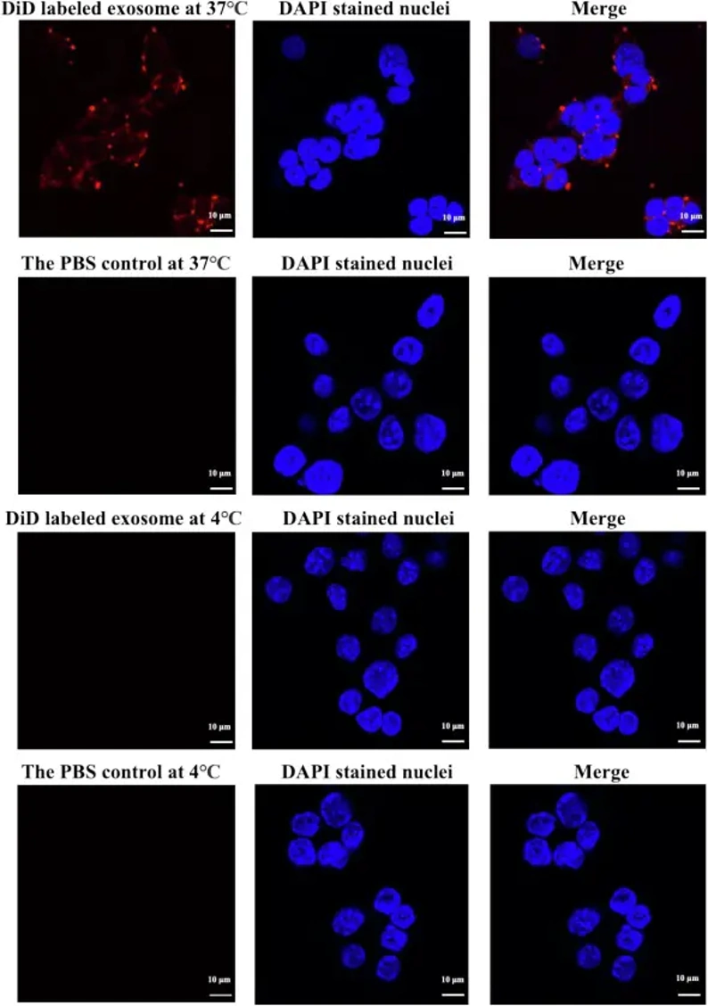 Uptake of T. pisiformis cysticercus exosomes by rabbit peritoneal macrophages.