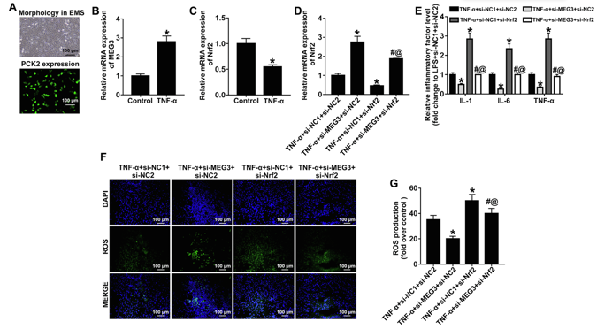 Knockdown of MEG3 alleviated TNF-α-induced inflammation and oxidative stress in rat bladder epithelial cells through upregulation of Nrf2.