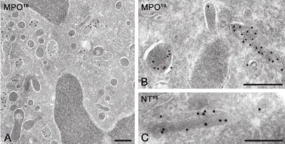 Electron micrographs of quiescent rat bone marrow neutrophils. Immunogold labeling is as indicated.