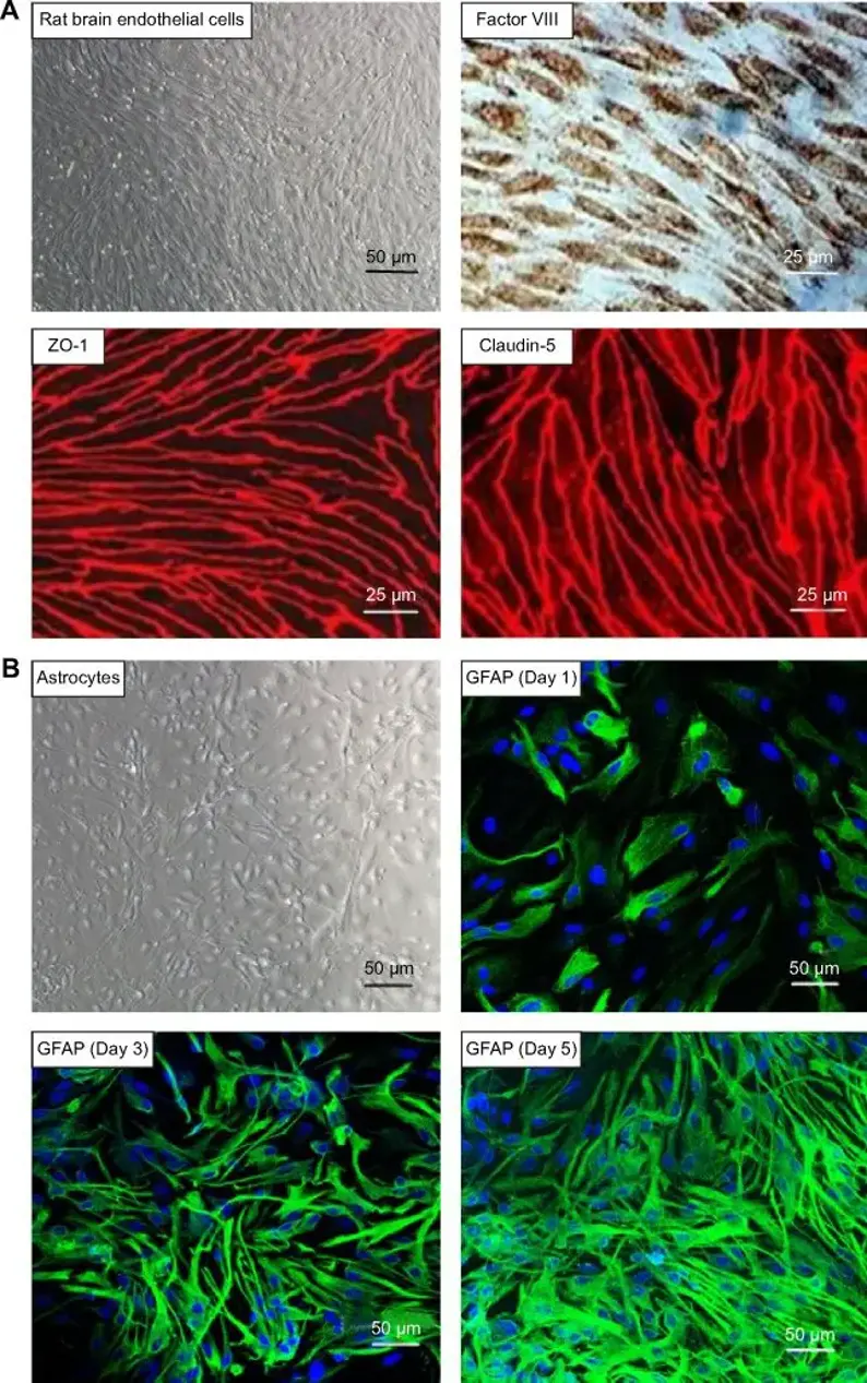 Characterization of primary rat brain microvascular endothelial cells.