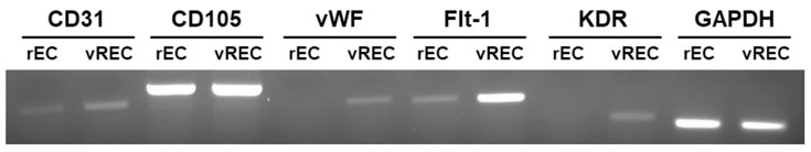 The expression of endothelial cell markers between rEC and vREC by RT-PCR.