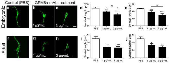 Representative images show embryonic and adult dissociated DRG neurons treated or not with the neutralizing GPM6a-mAb antibody for 24 h.