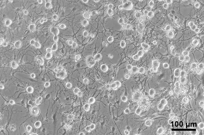 Adult Rat Dorsal Root Ganglion Neurons.