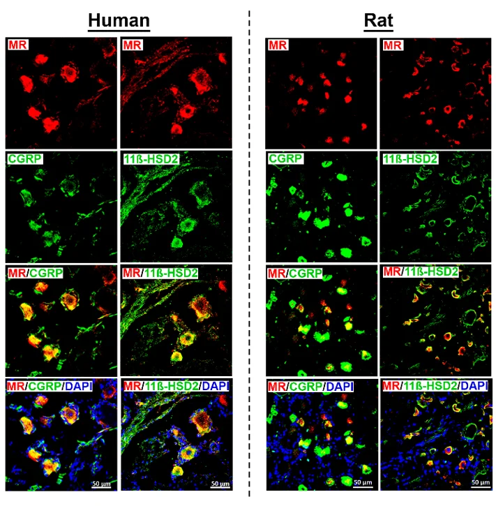 Detection of the mineralocorticoid receptors (MRs) with the peripheral sensory neuron marker CGRP and its protecting enzyme 11ß-HSD2 in human (left panel) and rat (right panel) sensory DRG neurons.