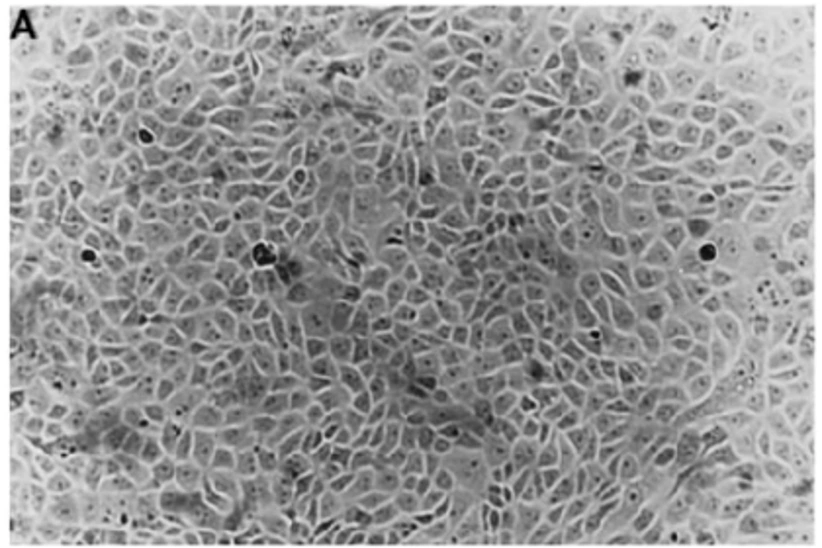 Morphology of uterine epithelial cell primary cultures.