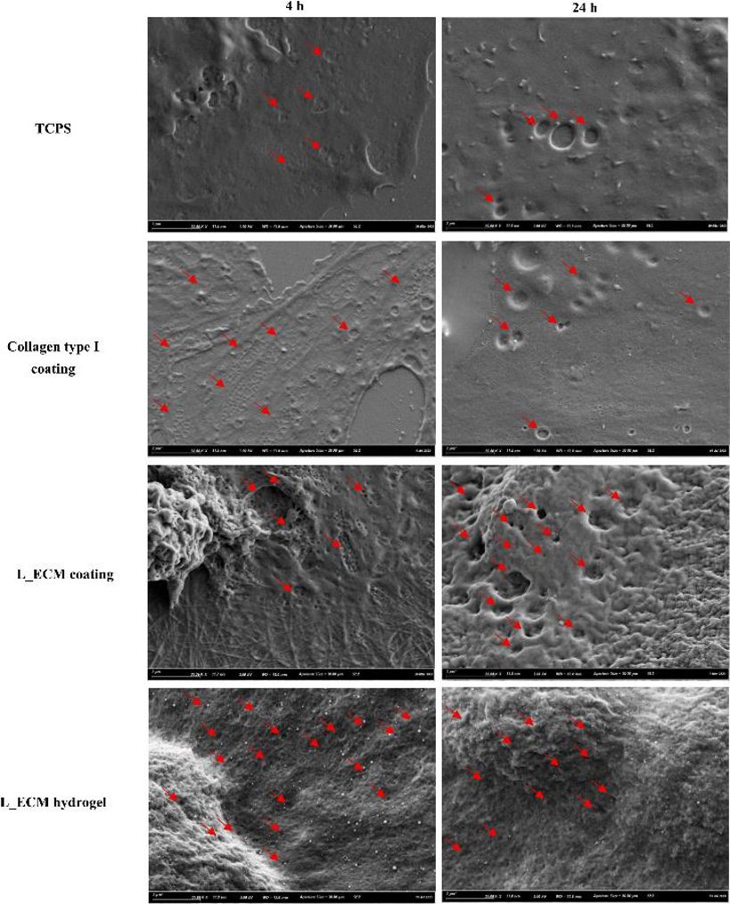 L-ECM hydrogels slowed down the disappearance of the fenestrae of LSECs in vitro.