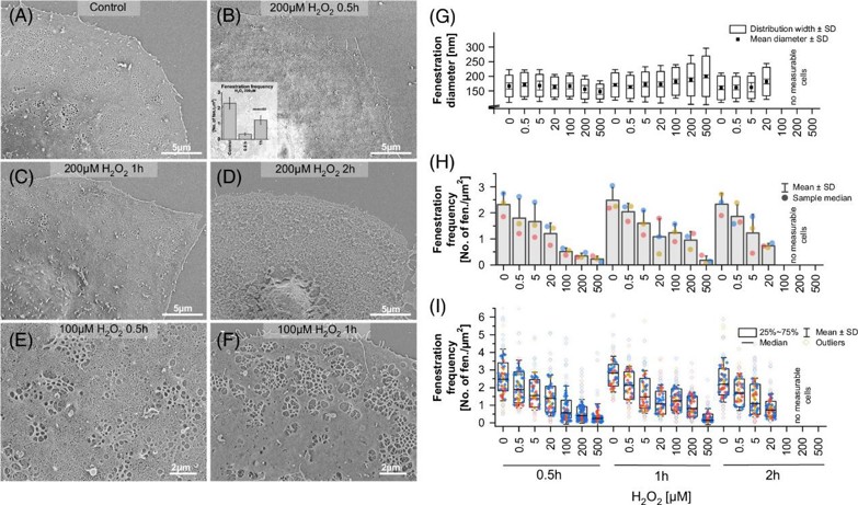 Changes in LSEC fenestrated morphology after exposure to H2O2.