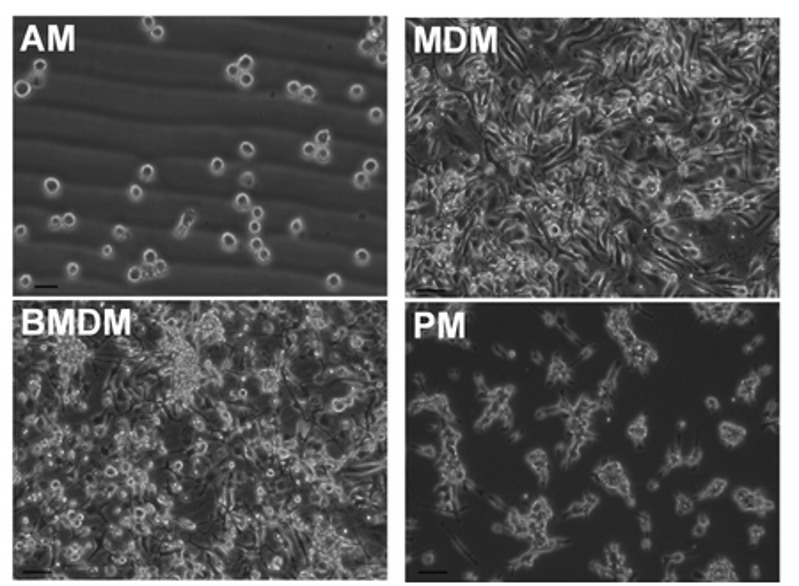 Macrophages were isolated from adult male Dark Agouti rats. Images are representative of cells isolated from 10 rats. Bars = 20 µm (AM) or 50 µm (BMDM, MDM, and PM).