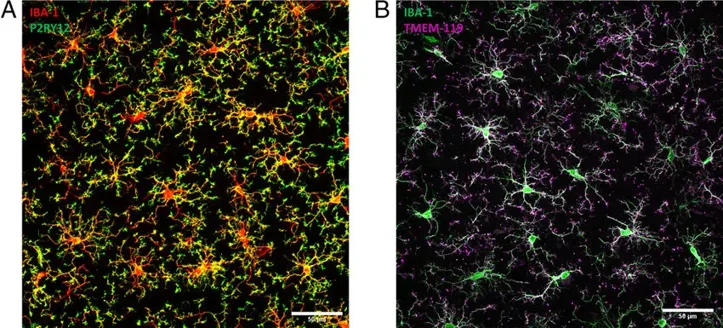 Imaging of microglia. (A and B) Shown are representative images of adult rat cortical microglia identified by double immunofluorescent labeling for anti-IBA-1 Ab (red) and anti-P2RY12 Ab (green) or anti-IBA-1 (A) or Ab (green) and anti-TMEM-119 Ab (magenta) (B).