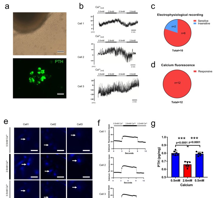 Normal rat parathyroid cells respond to changes in 19 extracellular calcium.
