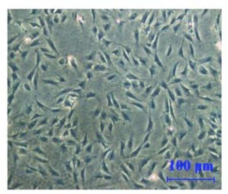Cell morphology of first passage of neonatal rat CFs under an optical microscope.