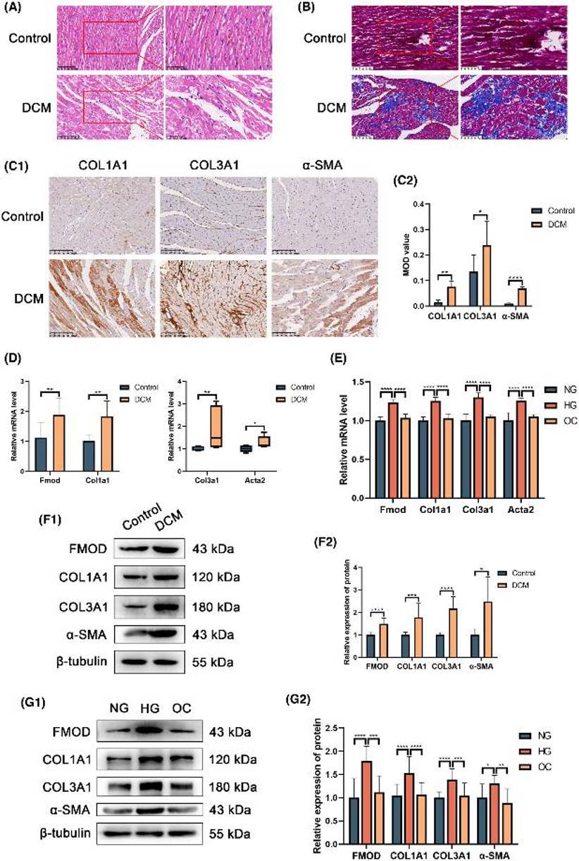 Fibrosis indicators and Fmod increased in DCM rat hearts and RPCFs treated with high glucose.