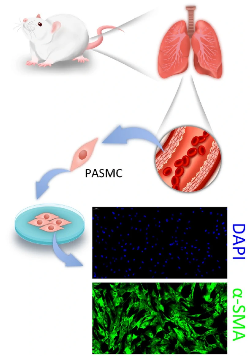 PASMC primary cells were isolated from rat pulmonary arteries after hypoxia-induced pulmonary hypertension.