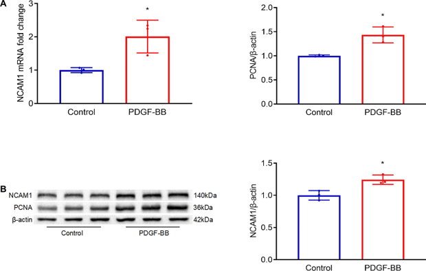 NCAM1 expression is upregulated in PASMCs treated with PDGF-BB.