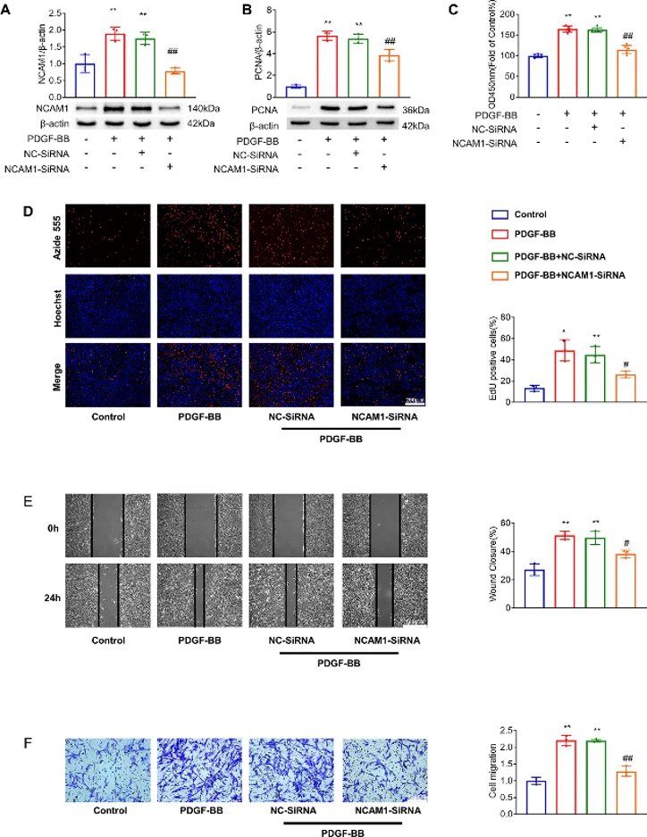 NCAM1 contributes to the proliferation and migration of PDGF-BB-induced PASMCs. PASMCs were treated with or without NCAM1 siRNA for 24 h before PDGF-BB (20 ng/mL, 24 h) treatment.