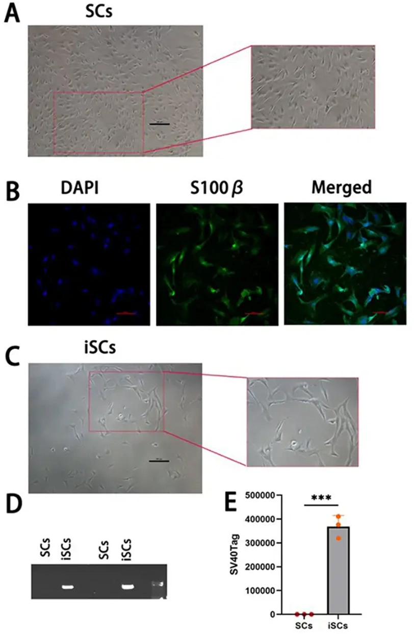 Characterization of primary and immortalised Schwann cells.