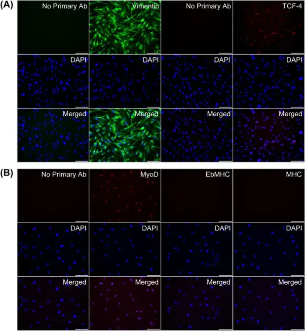 Primary fibroblast characterization.