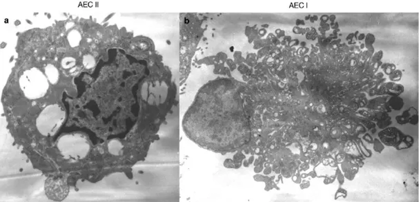 Electron microscopy images of AEC I and II. Original magnifications: (a) AEC II × 7200; (b) AEC I × 4800.