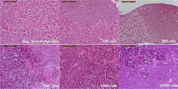 Microscopic findings: RCH-ACV cell line. Hematoxylin and eosin-stained sections of liver from mice grafted with RCH-ACV leukemic cells.