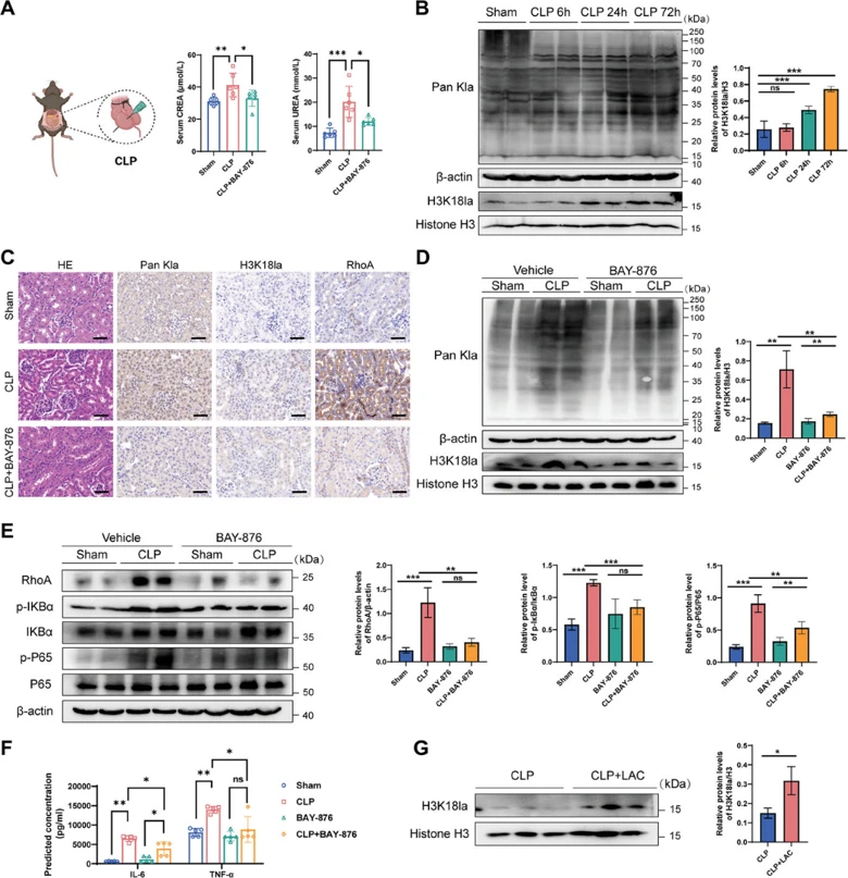 GLUT1 inhibition reduces H3K18la and improves renal function impairment after SA-AKI.