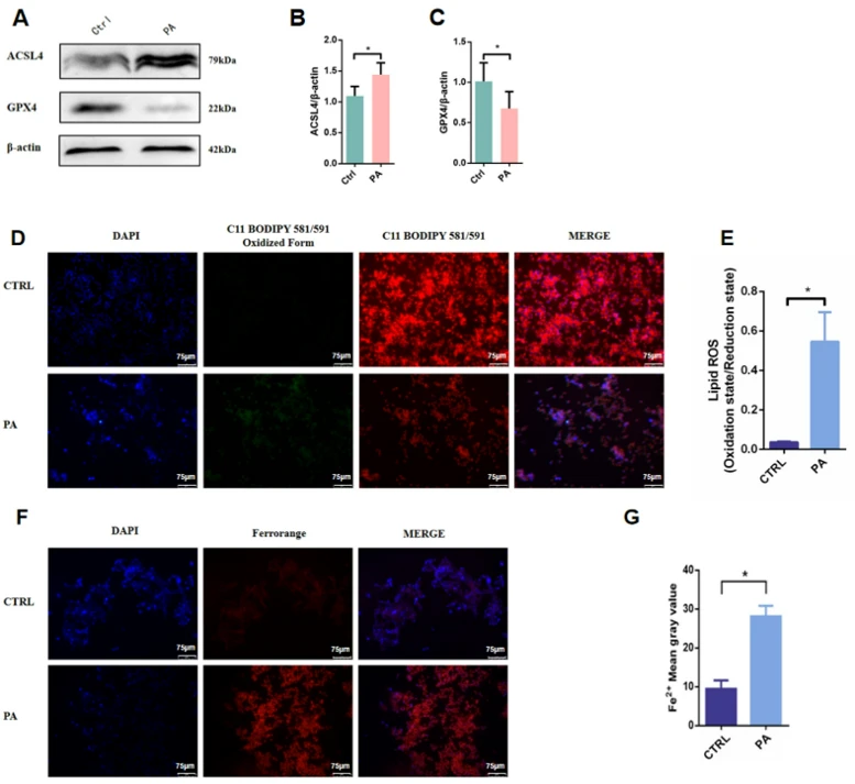 Impact of palmitic acid on ferroptosis.