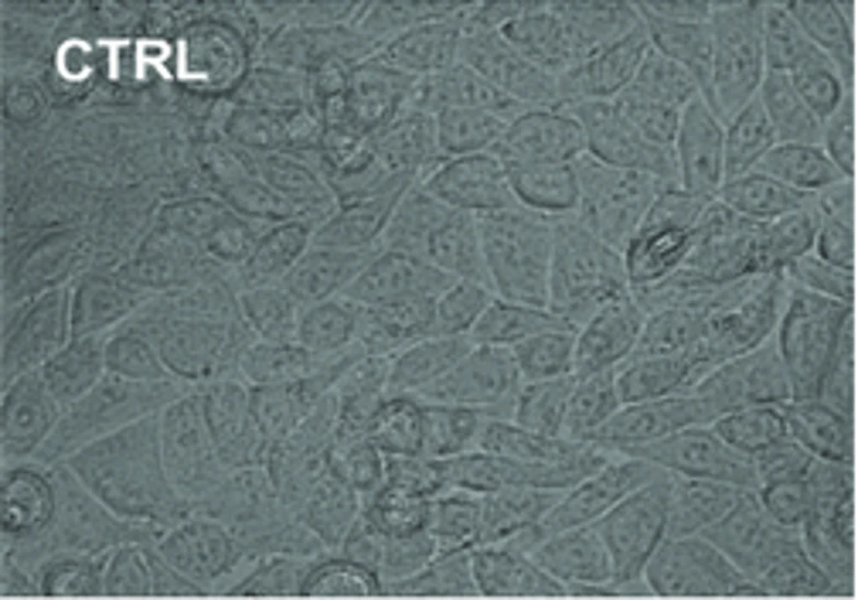 RKO colorectal cancer cell line.