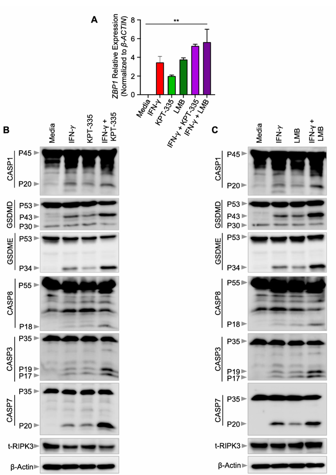 Upregulation of ZBP1 induces PANoptosis in melanoma cells