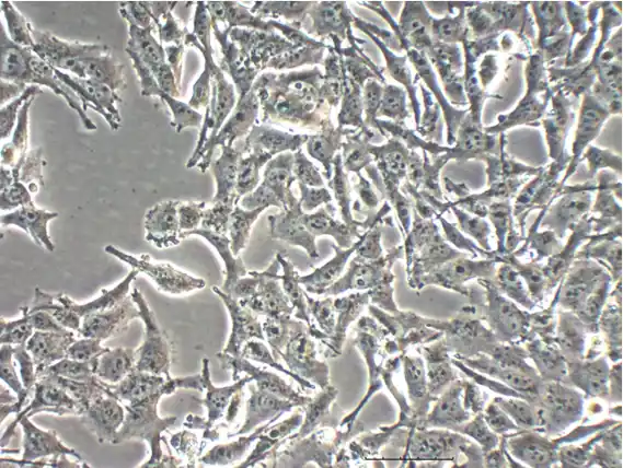 Example of a human malignant melanoma SK-MEL-2 cell line.
